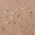 Merck Anti-ARL3 antibody produced in rabbit