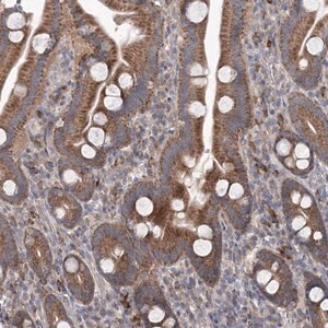 Merck Anti-MTRF1L antibody produced in rabbit