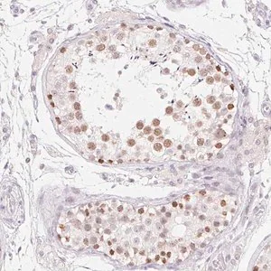 Merck Anti-MORC1 antibody produced in rabbit