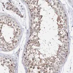 Merck Anti-SPATA5 antibody produced in rabbit