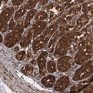 Merck Anti-PIK3C2A antibody produced in rabbit
