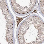 Merck Anti-KBTBD4 antibody produced in rabbit
