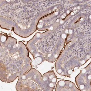 Merck Anti-TCHP antibody produced in rabbit
