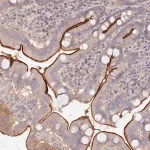 Merck Anti-TCHP antibody produced in rabbit