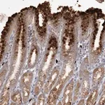 Merck Anti-SLC41A2 antibody produced in rabbit