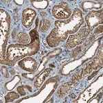 Merck Anti-C10orf90 antibody produced in rabbit
