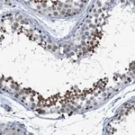 Merck Anti-TRPT1 antibody produced in rabbit