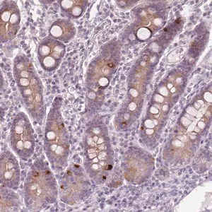 Merck Anti-PRAP1 antibody produced in rabbit