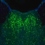 Merck Anti-NAGLU antibody produced in rabbit