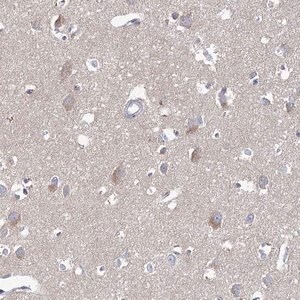 Merck Anti-ARHGAP44 antibody produced in rabbit