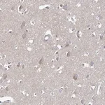 Merck Anti-ARHGAP44 antibody produced in rabbit