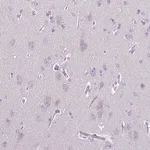 Merck Anti-ACTRT3 antibody produced in rabbit