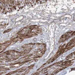 Merck Anti-ZSWIM6 antibody produced in rabbit