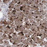 Merck Anti-UBR1 antibody produced in rabbit