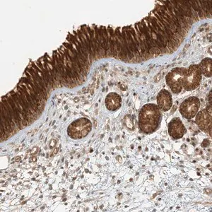 Merck Anti-KIAA0232 antibody produced in rabbit