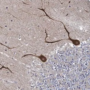 Merck Anti-INPPL1 antibody produced in rabbit