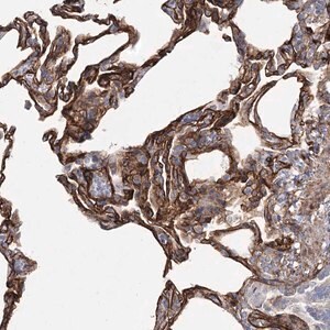 Merck Anti-TMEM164 antibody produced in rabbit