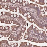 Merck Anti-ATE1 antibody produced in rabbit