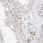 Merck Anti-EIF5A2 antibody produced in rabbit