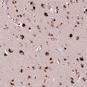 Merck Anti-CARD19 antibody produced in rabbit