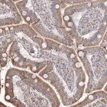 Merck Anti-RNF24 antibody produced in rabbit