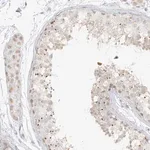 Merck Anti-DYRK1B antibody produced in rabbit