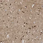 Merck Anti-NCOA7 antibody produced in rabbit