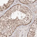 Merck Anti-TYSND1 antibody produced in rabbit