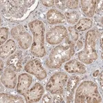 Merck Anti-FBXO31 antibody produced in rabbit