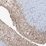 Merck Anti-UBE2E1 antibody produced in rabbit