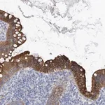 Merck Anti-PIK3C2B antibody produced in rabbit