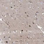 Merck Anti-PSEN1 antibody produced in rabbit