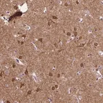 Merck Anti-PTPN5 antibody produced in rabbit