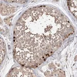 Merck Anti-OFD1 antibody produced in rabbit