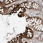 Merck Anti-BCORL1 antibody produced in rabbit