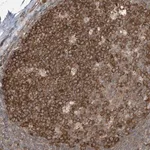 Merck Anti-TXNDC9 antibody produced in rabbit
