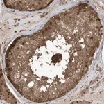 Merck Anti-MAPK1IP1L antibody produced in rabbit