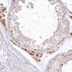 Merck Anti-MTMR3 antibody produced in rabbit