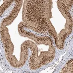 Merck Anti-CPSF3 antibody produced in rabbit
