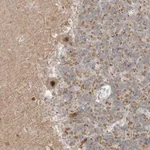 Merck Anti-MSL3 antibody produced in rabbit