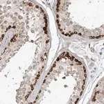 Merck Anti-MTMR3 antibody produced in rabbit