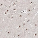 Merck Anti-WAC antibody produced in rabbit