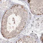Merck Anti-PIWIL4 antibody produced in rabbit