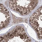 Merck Anti-ZNF622 antibody produced in rabbit