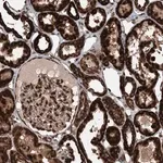Merck Anti-BCKDHA antibody produced in rabbit