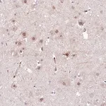 Merck Anti-PPP2R5B antibody produced in rabbit