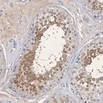 Merck Anti-C11orf58 antibody produced in rabbit