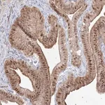 Merck Anti-ARHGAP21 antibody produced in rabbit