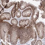 Merck Anti-NAA40 antibody produced in rabbit