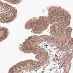 Merck Anti-TUBGCP2 antibody produced in rabbit